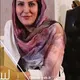دکتر زهرا خانی